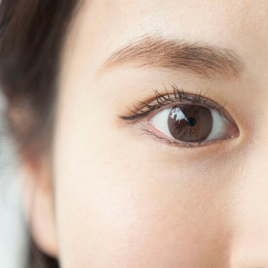Mediguide Istanbul: Eye Procedures  - Epicanthoplasty