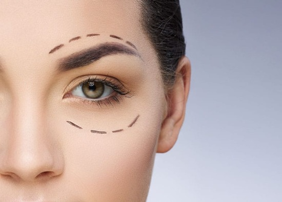 Mediguide Istanbul: Eye Procedures  - Eye Revision Surgery