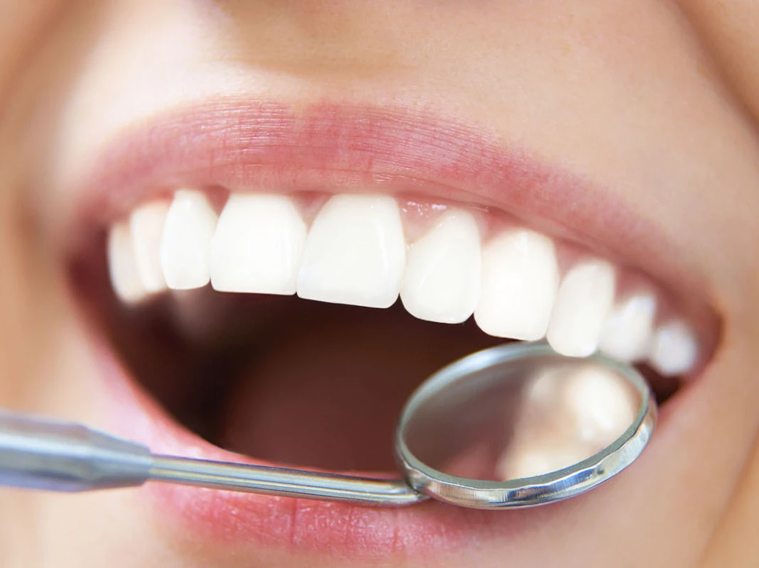 Mediguide Istanbul: Dental Surgery Procedures